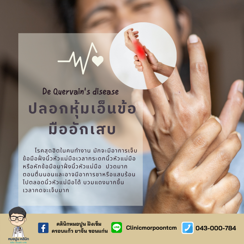 โรคปลอกหุ้มเอ็นข้อมืออักเสบ (De quervain’s disease)